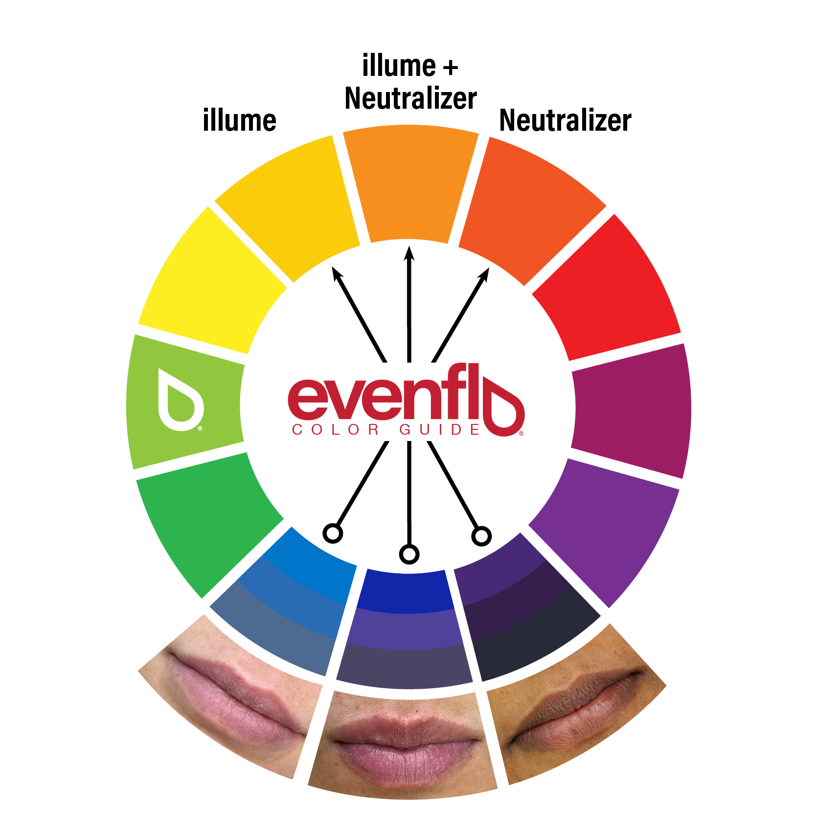 Evenflo Neutralizer Set